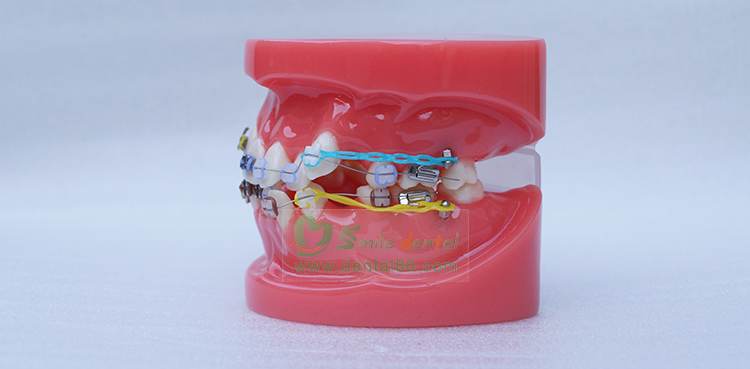 TM-B1-02 Orthodontic Model